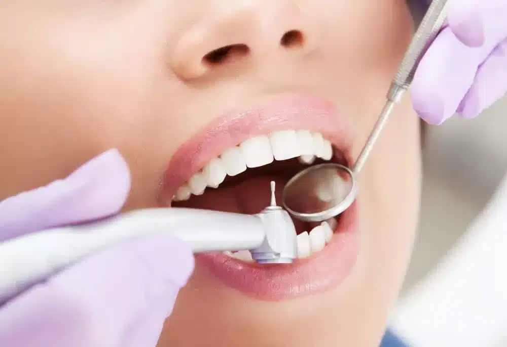 Tooth Extraction at soothing care dental | dental services at rozelle