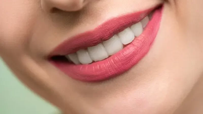 teeth whitening - soothing care dental - rozelle